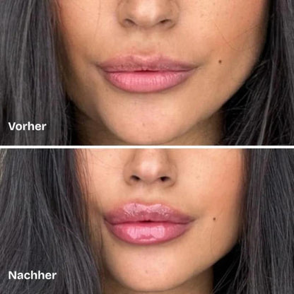 Lip Plumper – Cellumio™