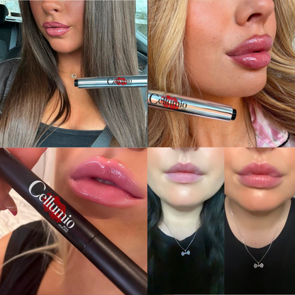 Lip Plumper – Cellumio™